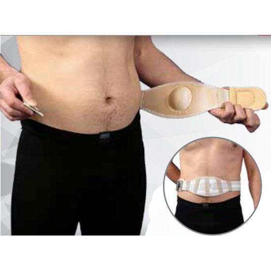 Ομφαλεπίδεσμος